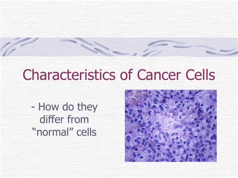 Characteristics Of Cancer Cells