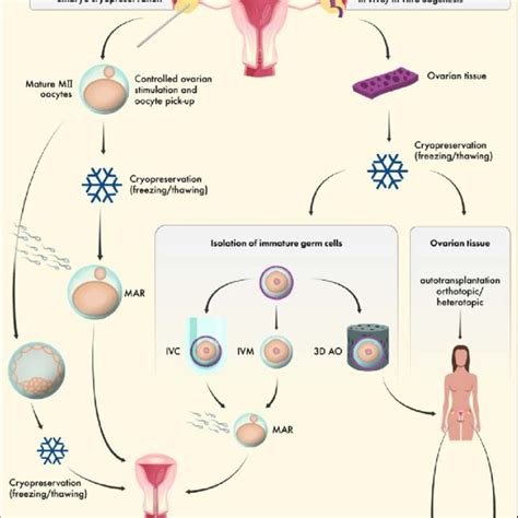 Strategies For Fertility Preservation In Male Patients Download Scientific Diagram