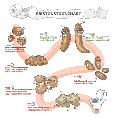 Die 7 Typen Des Stuhls Die Bristol Stuhlformen Skala Darmschoende