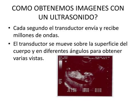 Principios B Sicos De Ultrasonido Ppt