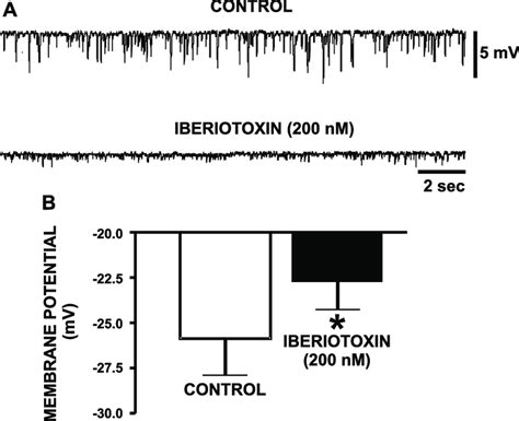 Inhibition Of The BK Channels By Iberiotoxin Eliminates The Spontaneous