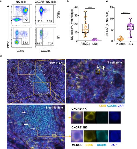 Implications Of The Accumulation Of Cxcr Nk Cells In Lymph Nodes Of