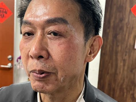 立院審選罷法藍綠再衝突 許智傑遭壓頭眼角挫傷 政治 Ctwant