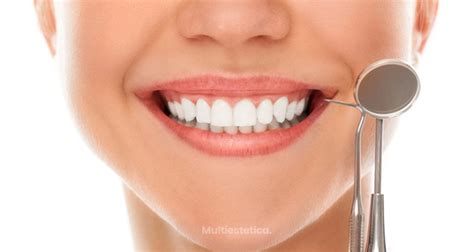 Consejos Vs Las Caries Y La Gingivitis Multiestetica Mx