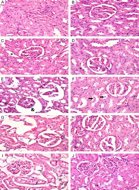 Hematoxylin And Eosin Staining Of Renal Tissues Of Control Con Rats