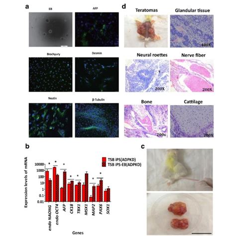 In Vitro And In Vivo Differentiation Of Adpkd Ipscs A Embryoid Body