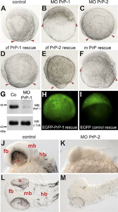 Prp Morpholino Knockdown And Rna Rescue In Zebrafish Embryos Af