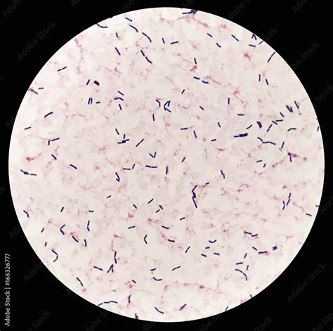 Bacillus Gram Stain 100x