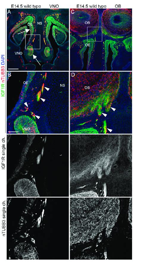 IGF1R Is Expressed By Neurons And Axons Migrating Extending From The