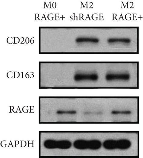 Classic protein markers of M2 macrophages (CD206 and CD163) assessed by ...