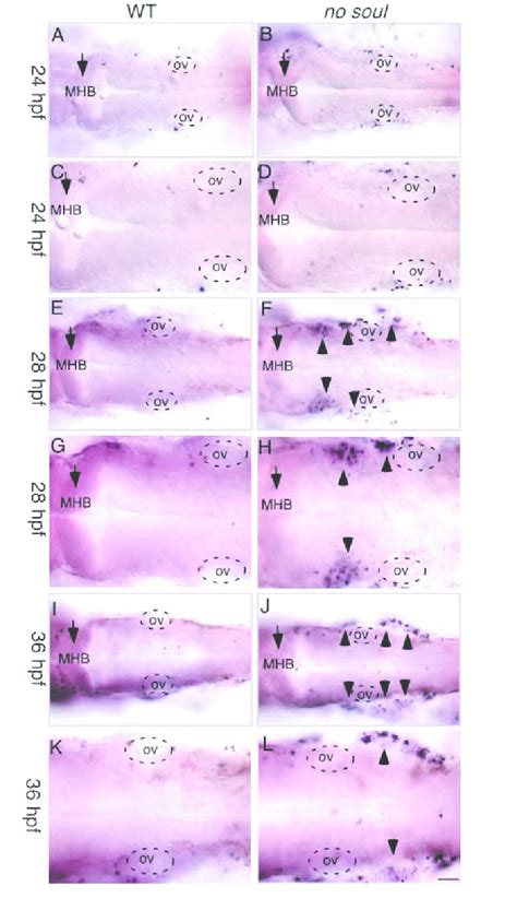 TUNEL Staining Of Whole Mount Wild Type Left And No Soul Mutant