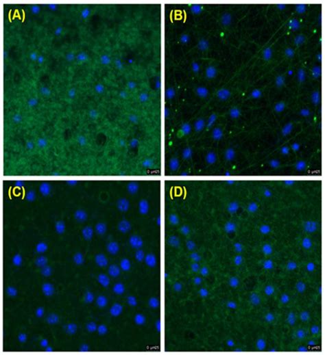 Polymers Free Full Text Effects Of Bilayer Nanofibrous Scaffolds Containing Curcumin