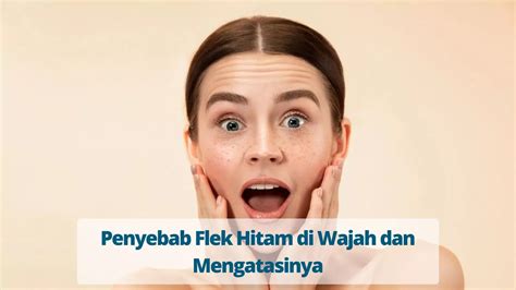 Penyebab Flek Hitam Di Wajah Dan Mengatasinya