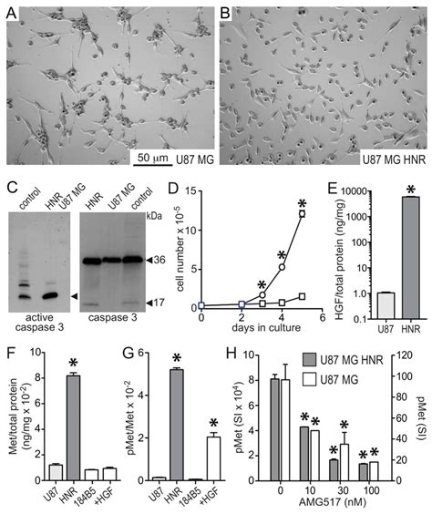 U87 Mg And U87 Mghnr Cell Morphology Proliferation Hgf Met And