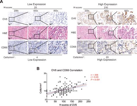 Intratumoral Ov Expression Is Positively Correlated With Cd Tam