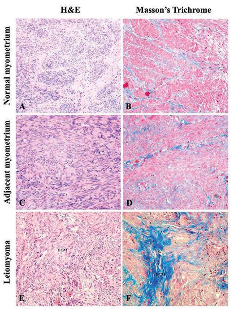 Hematoxylin Eosin And Massons Trichrome Stained Sections Of Human