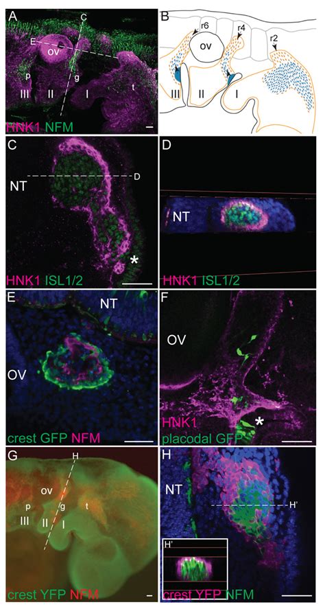 Neural Crest Cells Form Corridors Associated With Sensory Neuroblasts