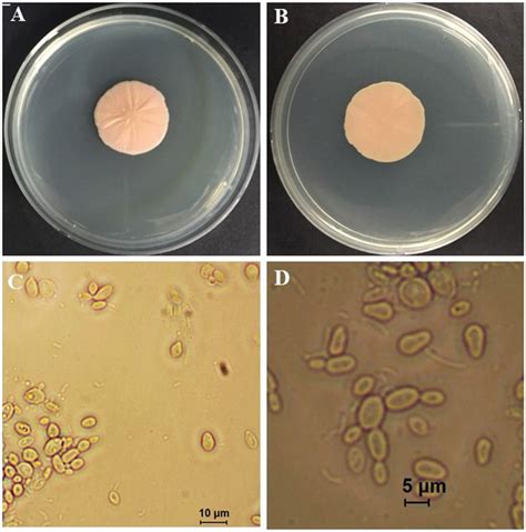 Yeast Stage Of Taphrina Deformans On Potato Dextrose Agar Plates A