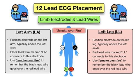 12 Lead Ecg Placement Diagram And Mnemonic For Limb And Precordial