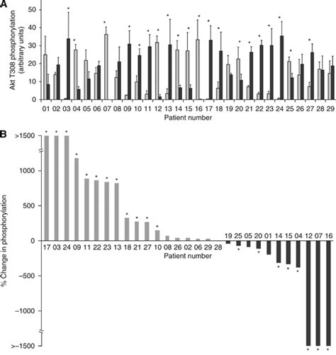 Phosphorylation Of Akt On Thr308 In Nsclc Tumour Tissue In Comparison Download Scientific