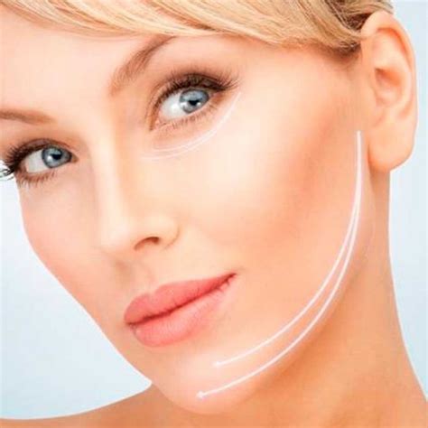 Lifting Facial Sin Cirug A Con Hifu Kinesiologiaestetica Cl