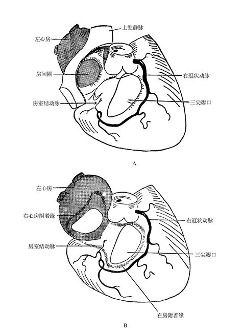 图7 3 左右心房的关系 心脏外科基础图解 医学