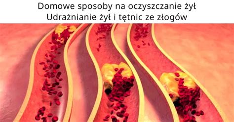 Domowe Sposoby Na Oczyszczanie Y Udra Nianie Y I T Tnic