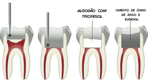 Dentista Responde 5 3 Questões De Concurso Público Para Dentista