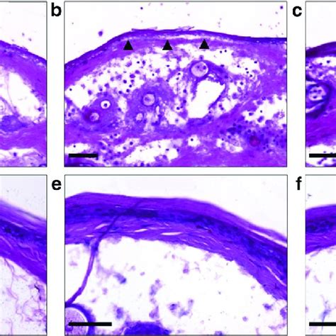 Anti Mlama Igg Induced Dermal Epidermal Separation Ex Vivo Depends On