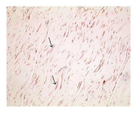 Example Of A Histological Section Taken Of The Posterior Layer Of Lf At