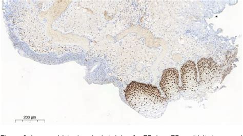 Figure 1 From Immunohistochemical Analysis Of Sex Hormone Receptors In