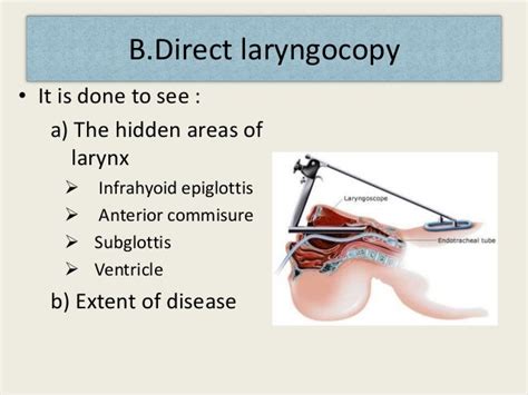 Diagnosis And Treatment Of Carcinoma Of Larynx By Nitesh Kr