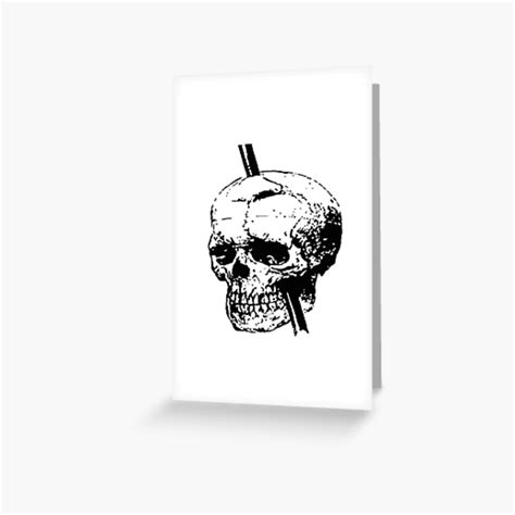 Skull With Tamping Iron Diagram Front And Lateral View Greeting Card