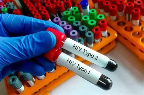 Penularan Hiv Yang Perlu Diwaspadai Menurut Dokter Indah Gianawati