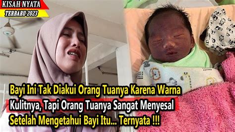 Bayi Ini Tak Diakui Orang Tuanya Setelah Melihat Warna Kulitnya Namun