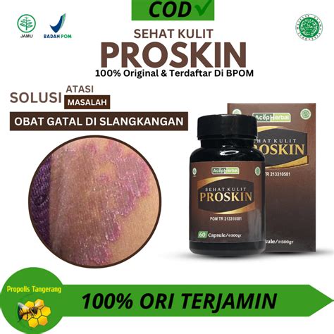 Jual Obat Gatal Gatal Di Slangkangan Gatal Gatal Diseluruh Badan Eksim