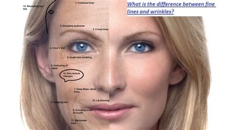 Wrinkles And Fine Lines Whats The Difference Read More Here