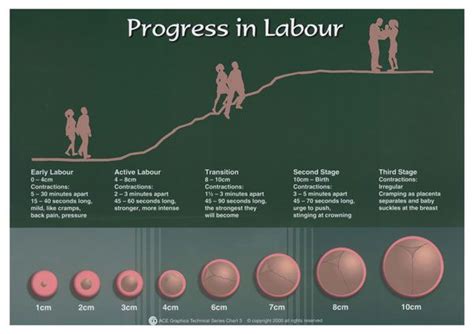 Progress In Labour Chart Cervix Dilation Chart Cervix Dilation