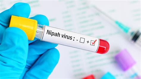 What Is Nipah Virus And What Are Its Symptoms And Treatment HealthShots