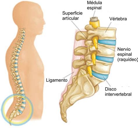 Estenosis De La Columna Lumbar Lumbar Spinal Stenosis Orthoinfo Aaos