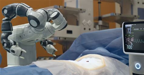 Tumore Alla Trachea Primo Intervento Di Resezione Con Robot