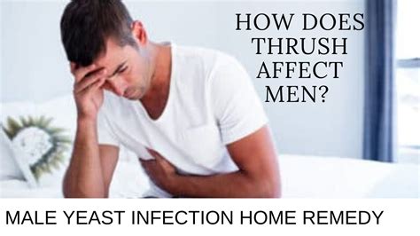 How does thrush affect men? | male yeast infection home remedy - YouTube