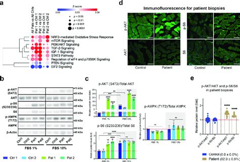 The PI3K Akt MTORC1 Axis Is Upregulated In The M 3243 A G Mutant