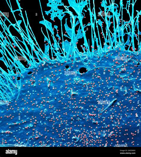 HIV Infected 293T Cell Coloured Scanning Electron Micrograph SEM Of