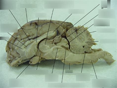 Sheep Brain Dissection Midsagittal Diagram Quizlet