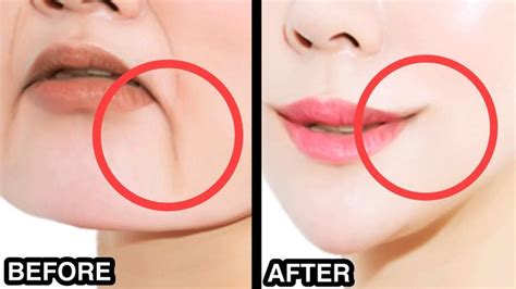 5mins!! Anti-Aging Face Exercise to Reduce Marionette Lines, Lift Droopy Mouth Corners, Sagging ...