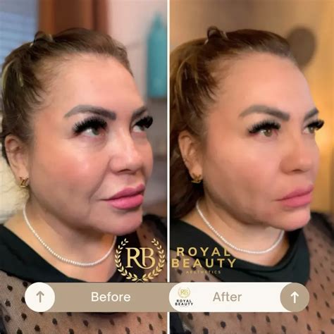 Gallery Royal Beauty Aesthetics