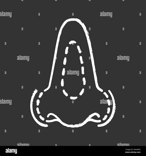 L icône Chalk rhinoplastie Remodelage du nez La chirurgie plastique
