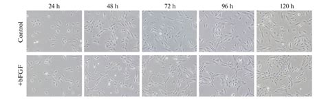 Cell culture of adult human retinal pigment epithelium (RPE) in the ...