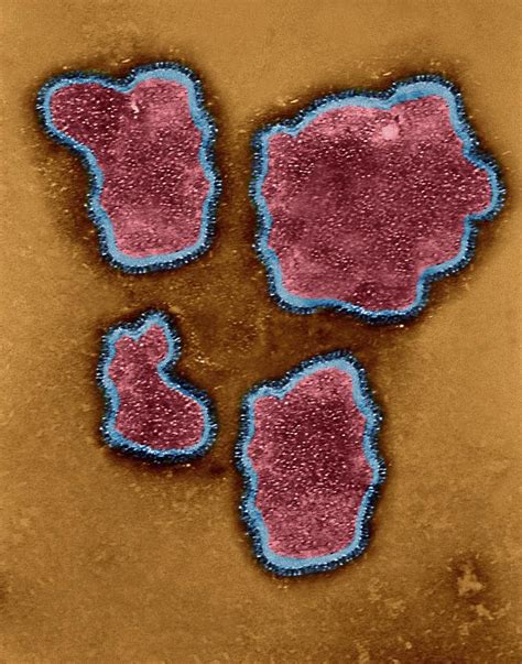 Respiratory Syncytial Virus Photograph By Dennis Kunkel Microscopy